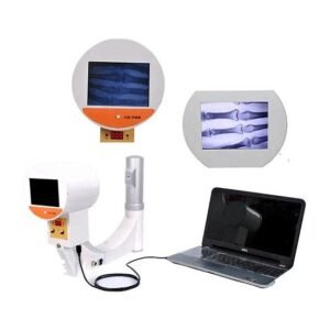 Portable X-Ray And Fluoroscopy Machine