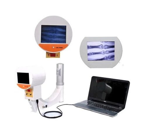 Portable X-Ray And Fluoroscopy Machine