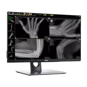 Digital DR Panel Radiography Wireless