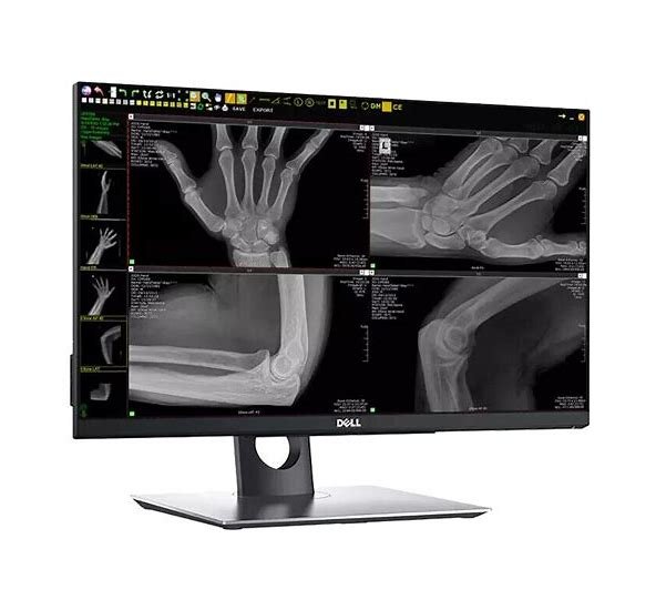 Digital DR Panel Radiography Wireless