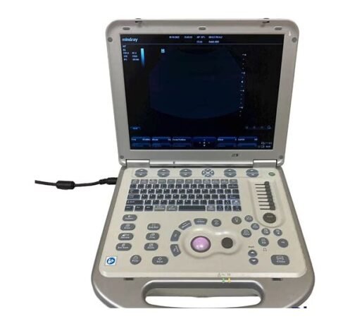 Advanced Cardiac Ultrasound Machine