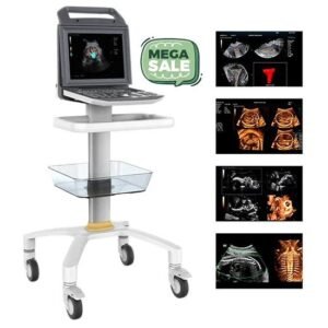 Portable 3D/4D Color Doppler Ultrasound