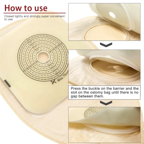 70mm 5Barriers/10Bags+5Barriers Ostomy Supplies Colostomy Bags Two Piece Drainable Pouches with hoop and look Stoma Care - Image 6