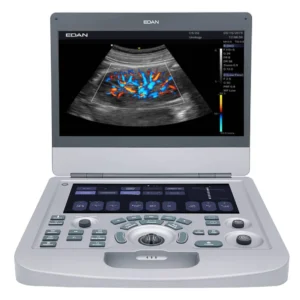 Compact Color Doppler Ultrasound System