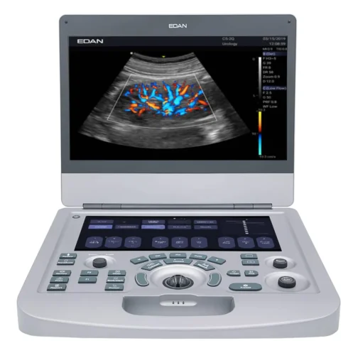 Compact Color Doppler Ultrasound System